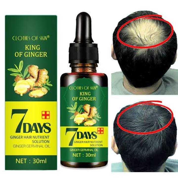7 Day Ginger Oil Natural Hair Loss Treatement Effective Fast Growth Hair Care 30ML